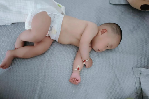 陕西宝宝头上长痱子